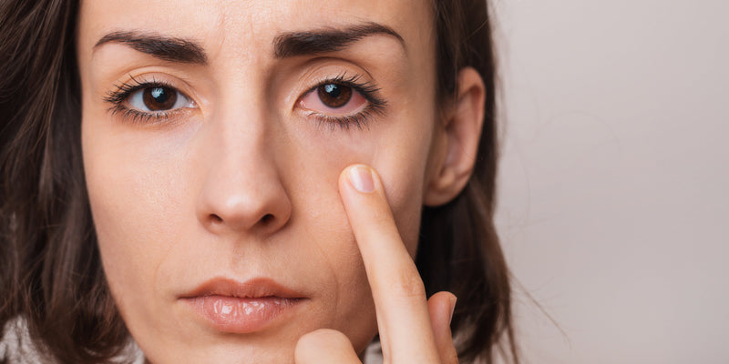 How to Support Your Occasional Eye Dryness