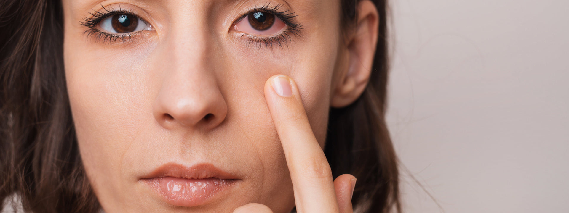 How to Support Your Occasional Eye Dryness