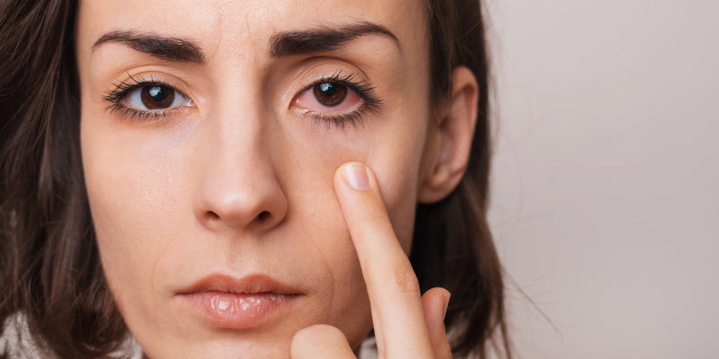 How to Support Your Occasional Eye Dryness